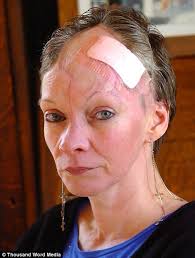 Julie Bloodworth. Horrific injuries: Julie Bloodworth, 47, suffered a broken skull and was left for dead in a hit and run - article-1283091-09D78AD3000005DC-623_468x618