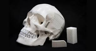 Eggshell-Based Surgical Material for Skull Injuries | ODT