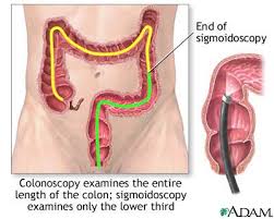 colonoscopy diet-here's the facts
