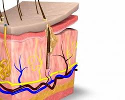 Image of الجلد