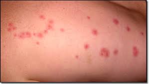 Image result for Signs of a Stink Bug Infestation