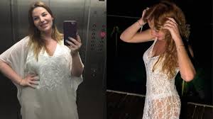 Luiza Zveiter revela sequelas da bariátrica e diz que perdeu dentes após cirurgia: 'Não é o caminho fácil'