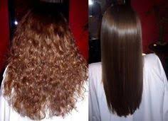 Image result for Best Hair Treatments uk