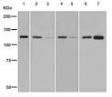 Vinculin western blot loading control