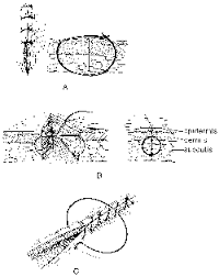 Image result for simple continuous suture pattern