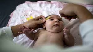 Znalezione obrazy dla zapytania Zika virus spreading Cnn youtube