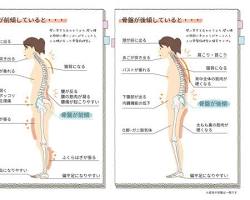 姿勢が悪いことによるお尻や骨盤への影響の画像