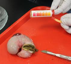 Image result for human stomach