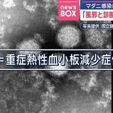 News source: Yahoo!ニュース
