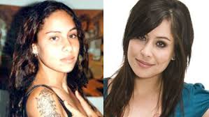 Resultado de imagem para antes e depois dos famosos