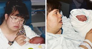 A Woman With Down Syndrome Gives Birth to a Boy With the ...