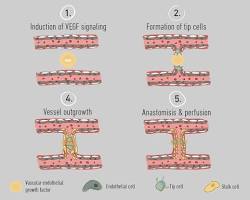 Image of VEGF angiogenesis process