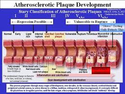 Résultat de recherche d'images pour "lower right arm"