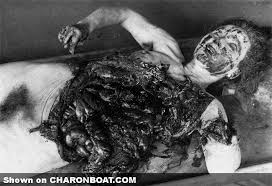 Image result for unit 731 torture