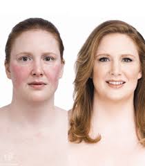 Jane Iredale - Before &amp; After - JaneIredale6