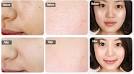 Many Seek to Minimize Enlarged Pores for a Flawless Look - The