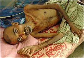 Hasil carian imej untuk TB IMAGES