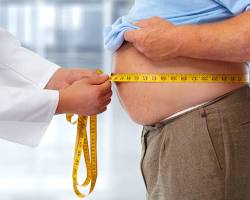 Imagem de Pessoa obesa