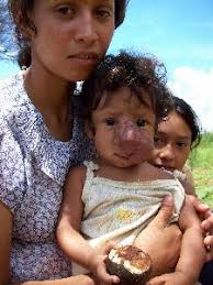 Resultado de imagen para muerte por glifosato
