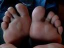 Foot blisters: to pop or not to pop?<a name='more'></a> Fox News
