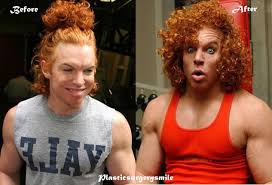 Résultat de recherche d'images pour "carrot top young"