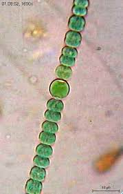 Hasil gambar untuk Anabaena sp