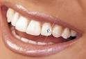 Bijoux dents