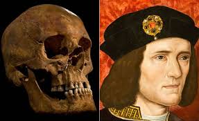 Photo: University of Leicester. Since the discovery of a grave under a parking lot in Leicester, England, presumed to be that of King Richard III, ... - richard-III-skull