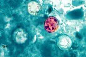 Mueren dos personas en Michigan por brote de ciclosporiasis