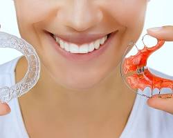 Invisalign retainer