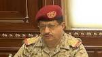 "المقدشي والحارثي" يتفقدان الأضرار التي