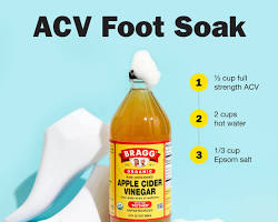 Elma sirkesi ayak banyosu Apple cider vinegar foot bath resmi