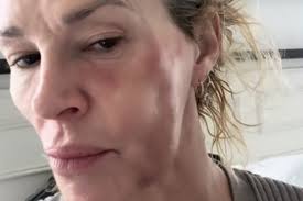 Brandi Glanville breaks down over medical bills - Nine.com.au