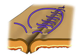 Image result for simple continuous suture pattern