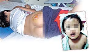 Hasil carian imej untuk KES DERA KANAK-KANAK DAN BAYI