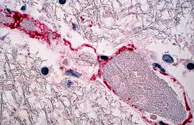 Nipah virus: why it is back in the global spotlight