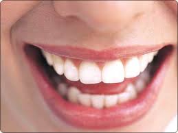 dental bonding cary, nc