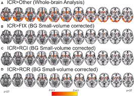 Image result for ventral striatum