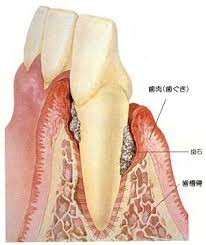 「掃除 site:https://www.8181118.com/」の画像検索結果