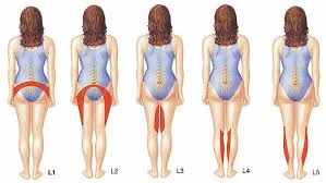 Image result for Prolapsed intervertebral disc