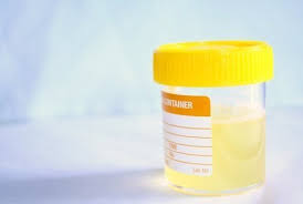 Hasil gambar untuk botol tes urine