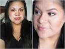 9 Vitiligo Transformations That Prove The Power Of Makeup