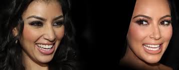 Résultat de recherche d'images pour "who is kim kardashian before and after"