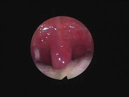 「のどちんこ」的圖片搜尋結果