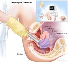 Image result for how to insert male organ into female organ