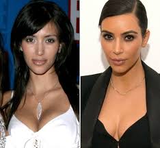 Résultat de recherche d'images pour "who is kim kardashian before and after"