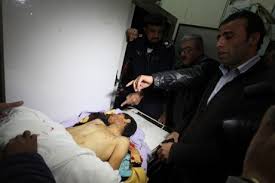 Image result for dead palestinian children