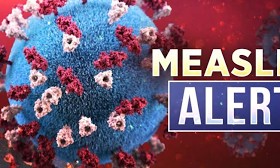 Measles case confirmed in eastern Iowa