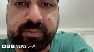 معترض زخمی خطاب به نیروی انتظامی: پشیمان نیستم؛ من هم جوانم، گرفتارم و گرسنه