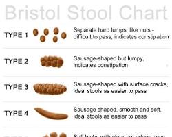 Constipation